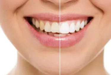 Odontologia estética com dentistas em Juiz de Fora na Odontoclamp